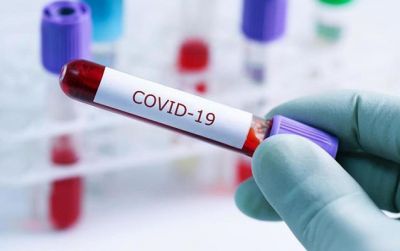 Günün koronavirus statistikası: 1622 yoluxma, 979 sağalma