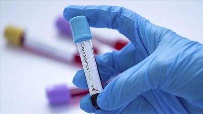 Erməni idnançıda koronavirus aşkarlandı